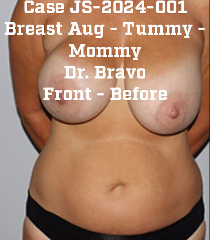 Before - JS-2024-001