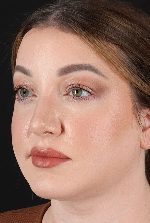 After - left_oblique