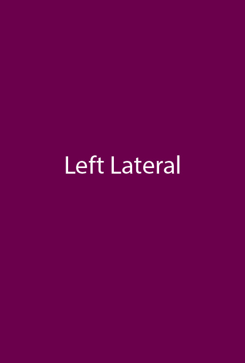 Before - left_lateral